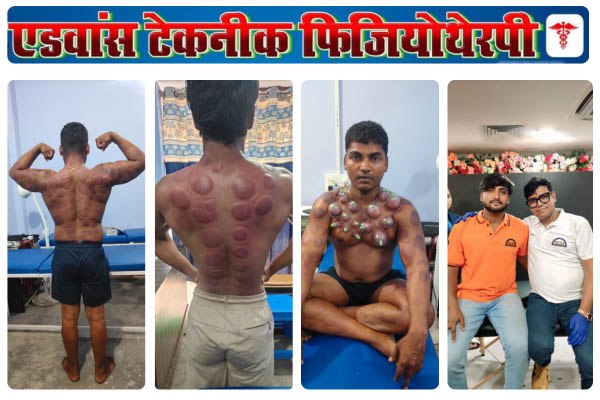 Advance Physiotherapy Nawada chiropractic and physiotherapy