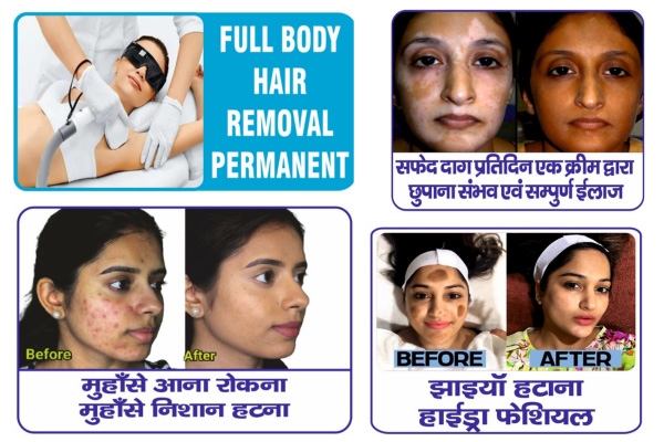 Skin Radiance Clinic Patna dermatology and laser clinic